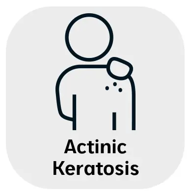 Actinic Keratosis Actinic Keratosis in Monroe, LA and Southlake, TX