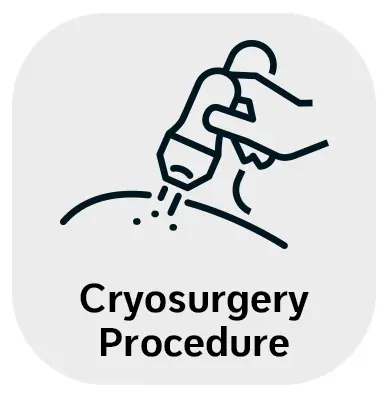 Cryosurgery Cryosurgery in Monroe, LA and Southlake, TX