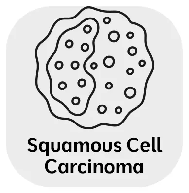 Squamous Cell Carcinoma Squamous Cell Carcinoma Treatment in Monroe, LA and Southlake, TX