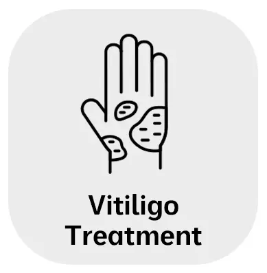 Vitiligo Treatment Vitiligo Treatment in Monroe, LA and Southlake, TX