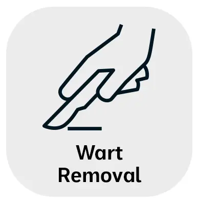 WartRemoval Wart Removal in Monroe, LA and Southlake, TX