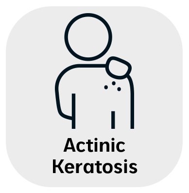 Actinic Keratosis in Monroe, LA and Southlake, TX