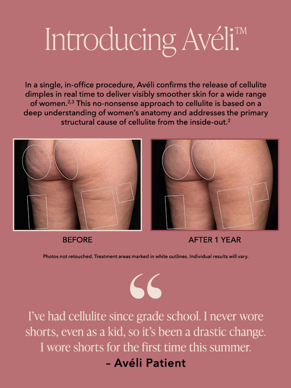 Aveli Cellulite Treatment in Chicago, IL - Chicago Medical Spa, Skin  Rejuvenation