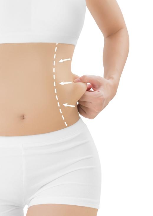 Body Contouring 101: Flank Edition - Hopkins Dermatology