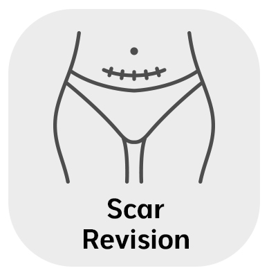 Scar Revision in Monroe, LA and Southlake, TX